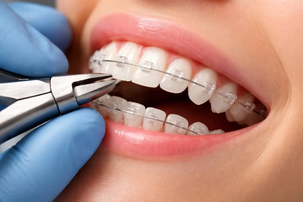 Specialist Orthodontist – Bristol, UK | Private Dental Pract…