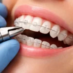 Specialist Orthodontist – Bristol, UK | Private Dental Practice | Full-Time / Part-Time